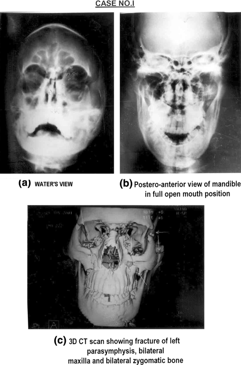 Fig. 1