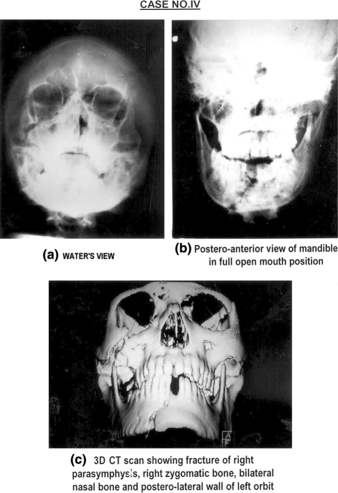 Fig. 4