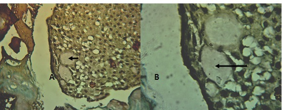 [Table/Fig-5]: