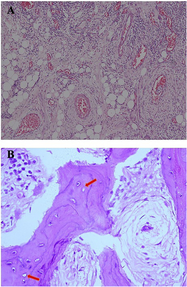 FIGURE 3