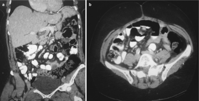 Fig. 23.2
