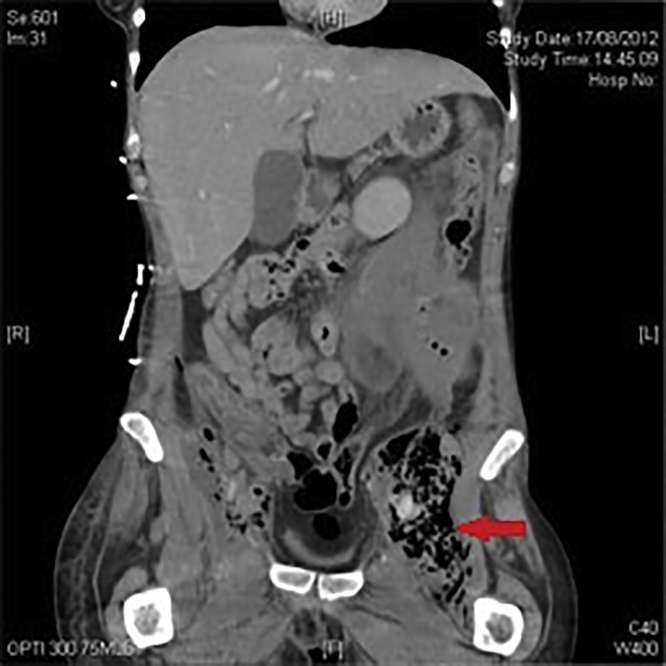 Fig. 2