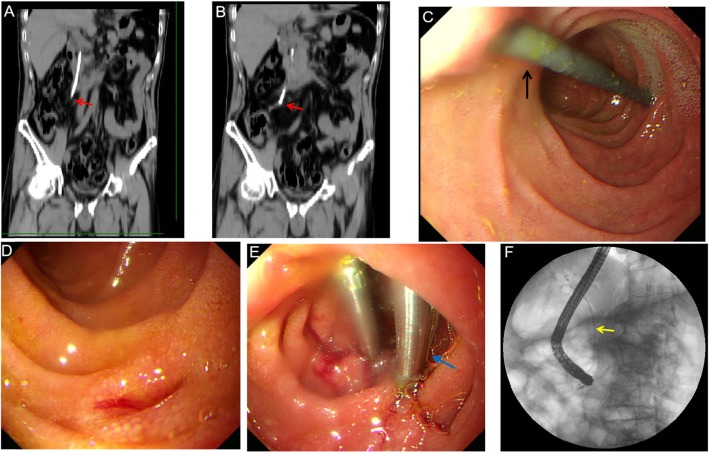 Fig. 1