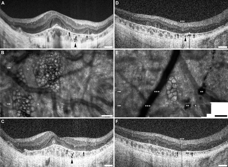 Fig 5