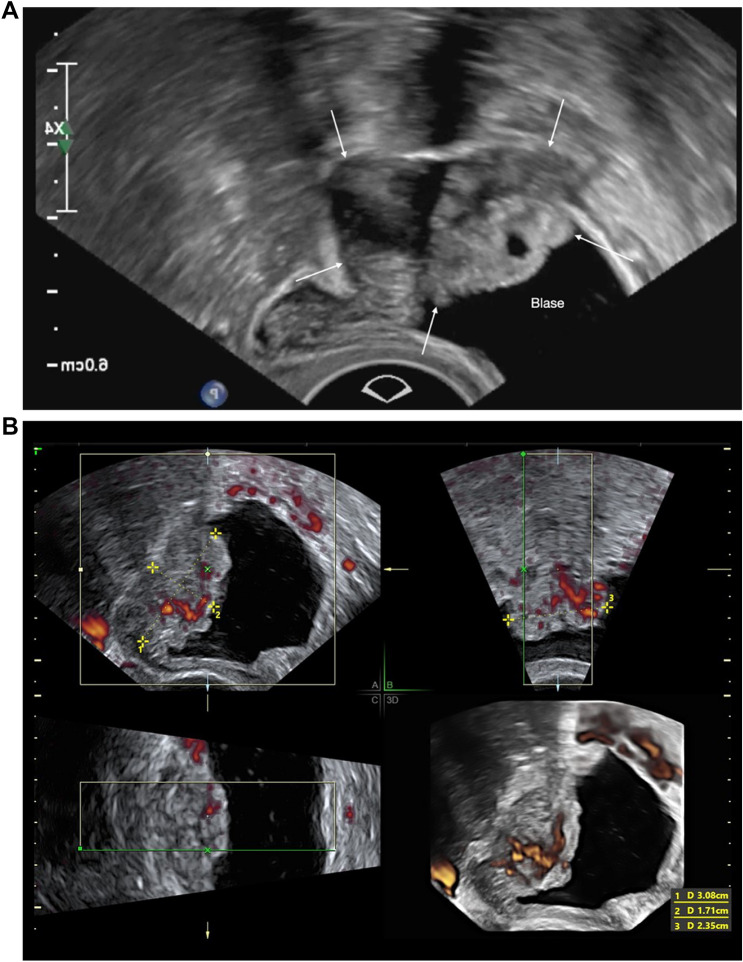 Fig. 5