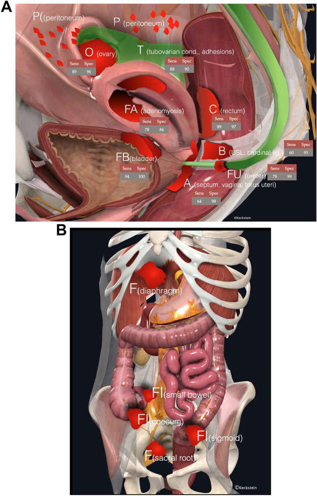 Fig. 14