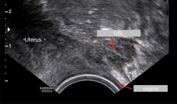 Fig. 10