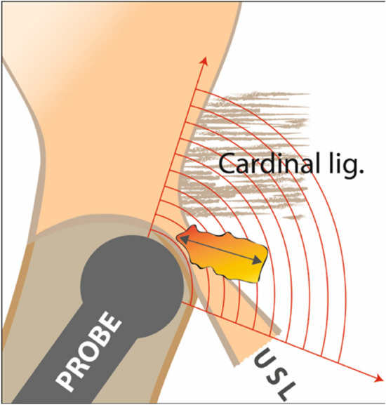 Fig. 9