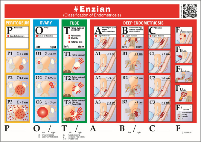 Fig. 13