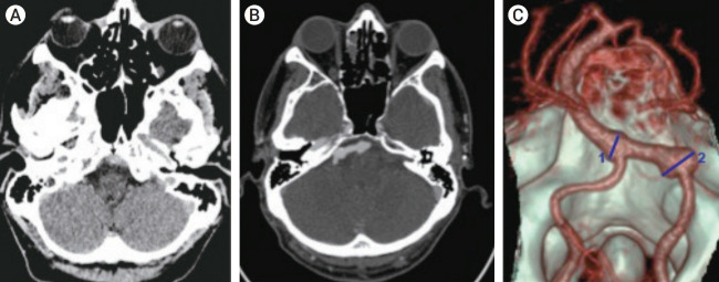 Fig. 1.