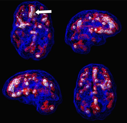 Fig. (7)