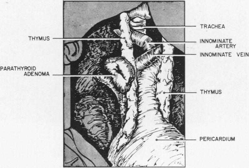 Fig. 11a.