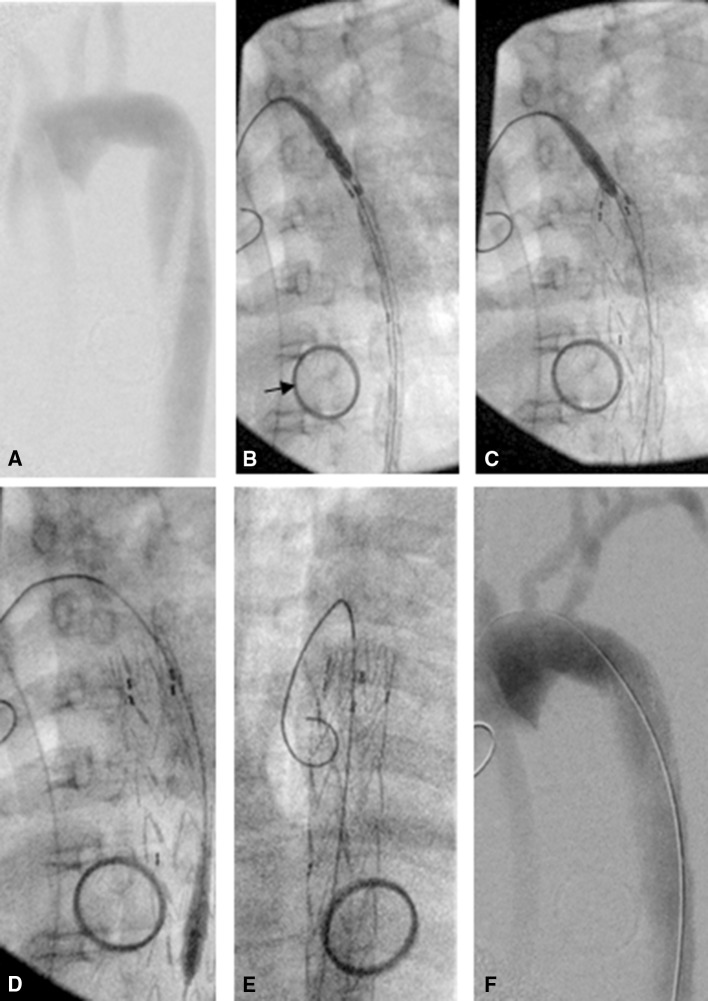 Fig. 2