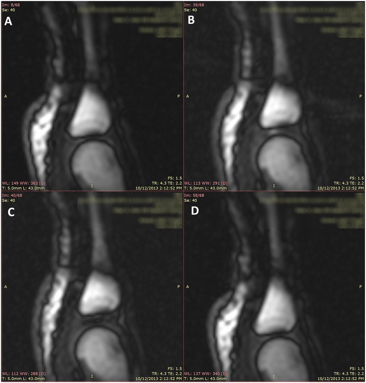 Fig 3