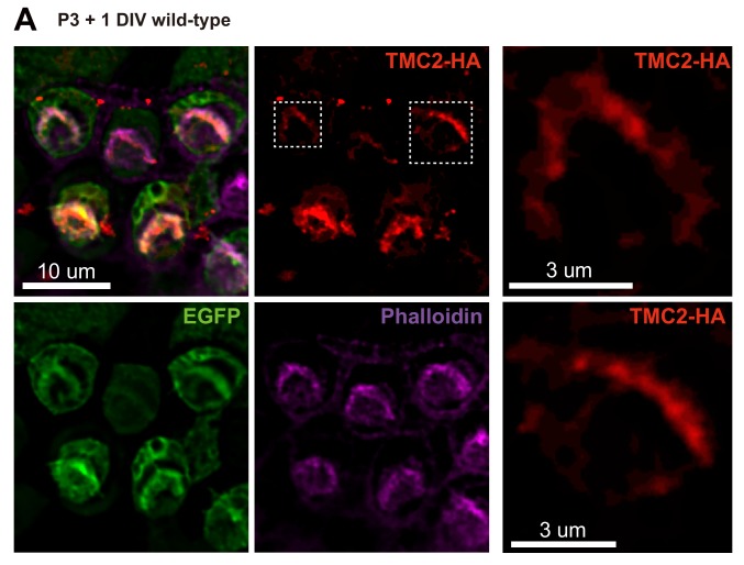 Figure 2—figure supplement 1.