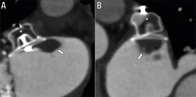 Figure 20