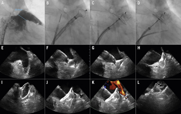 Figure 14