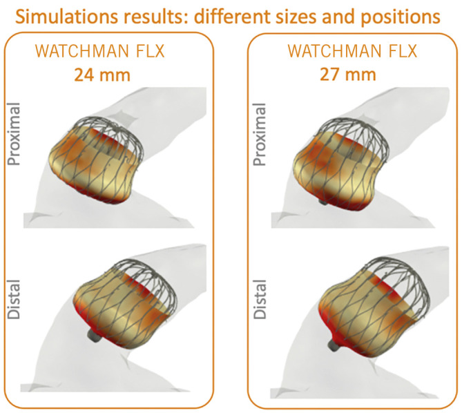 Figure 13