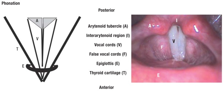 Figure 1a