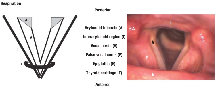 Figure 1b