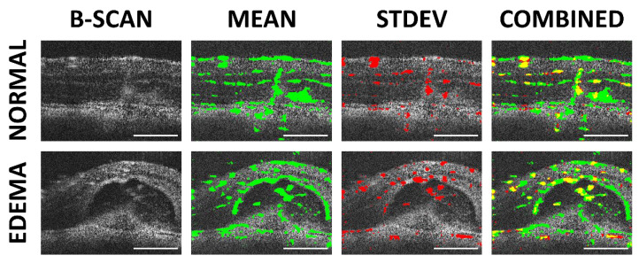 Figure 12