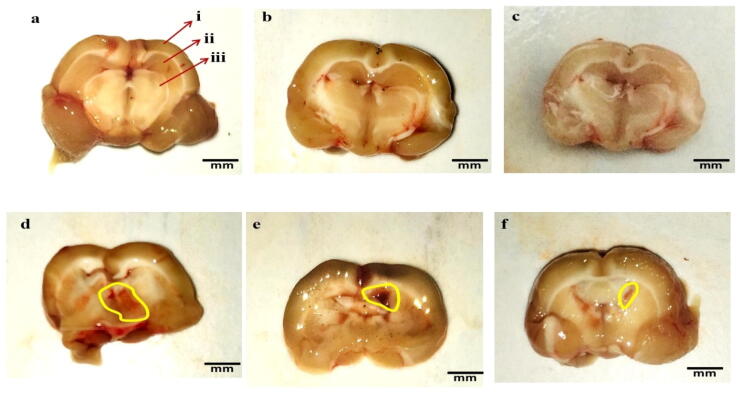 Fig. 10