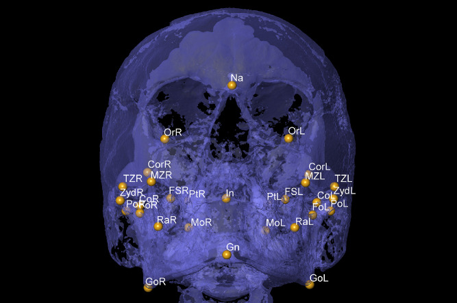 Fig 1