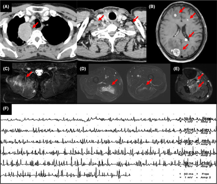 FIGURE 1