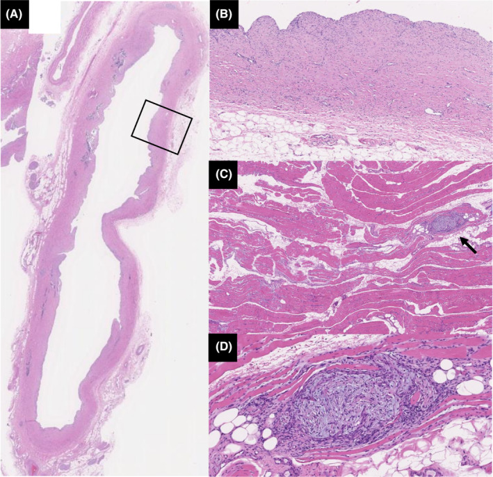 FIGURE 4