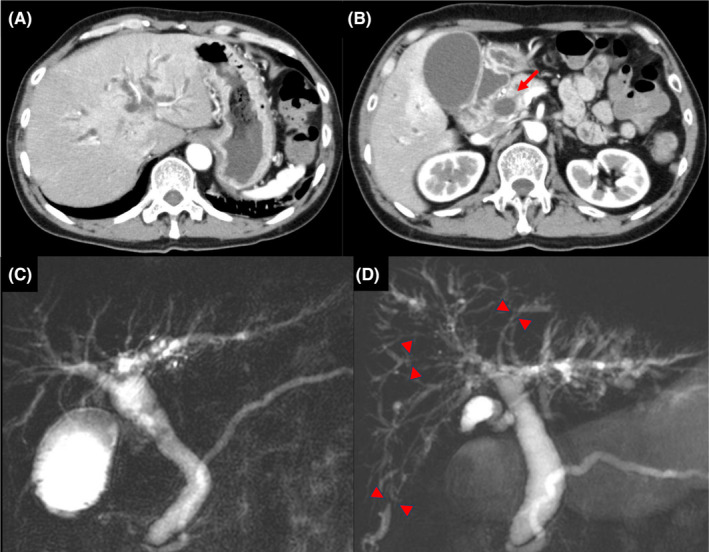 FIGURE 2