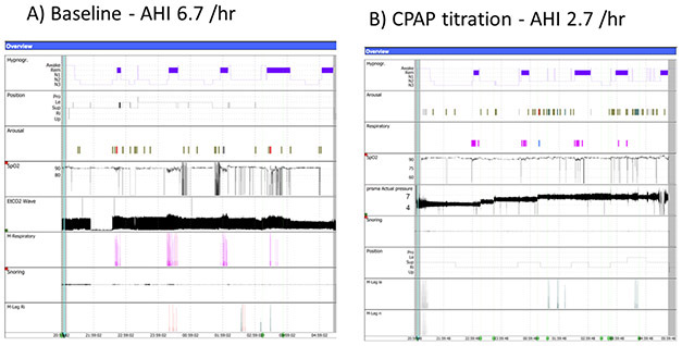 Figure 2: