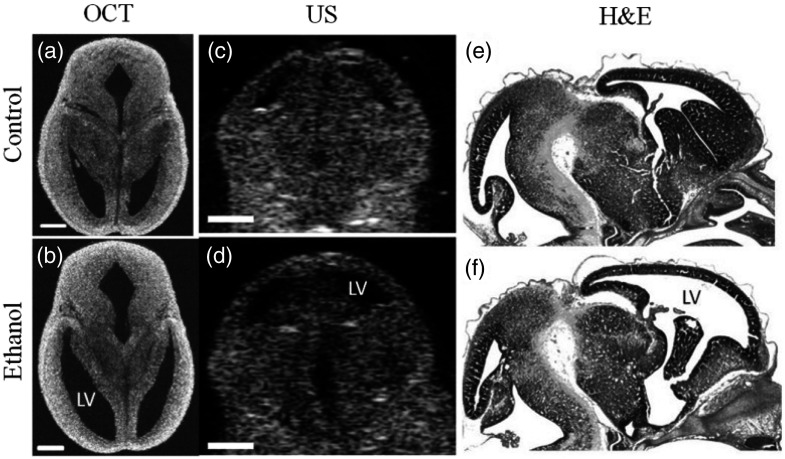 Fig. 13