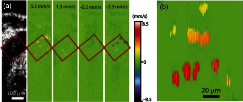 Fig. 15