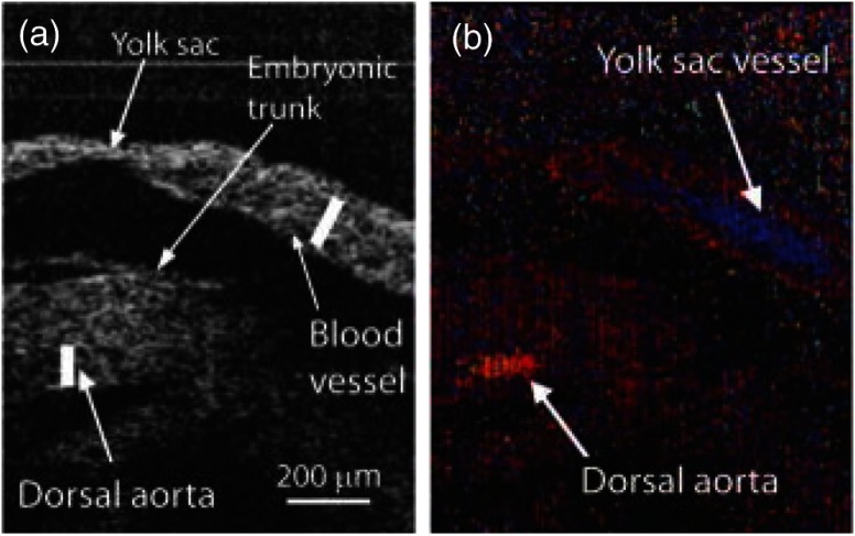 Fig. 14