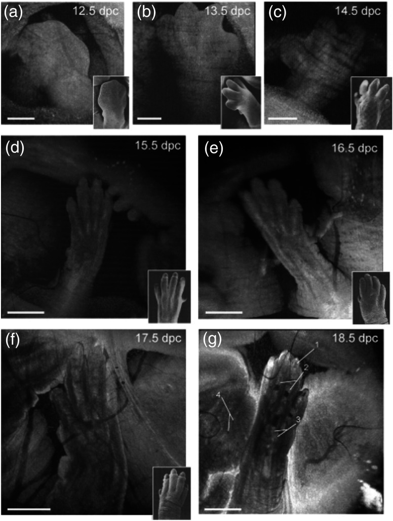 Fig. 11