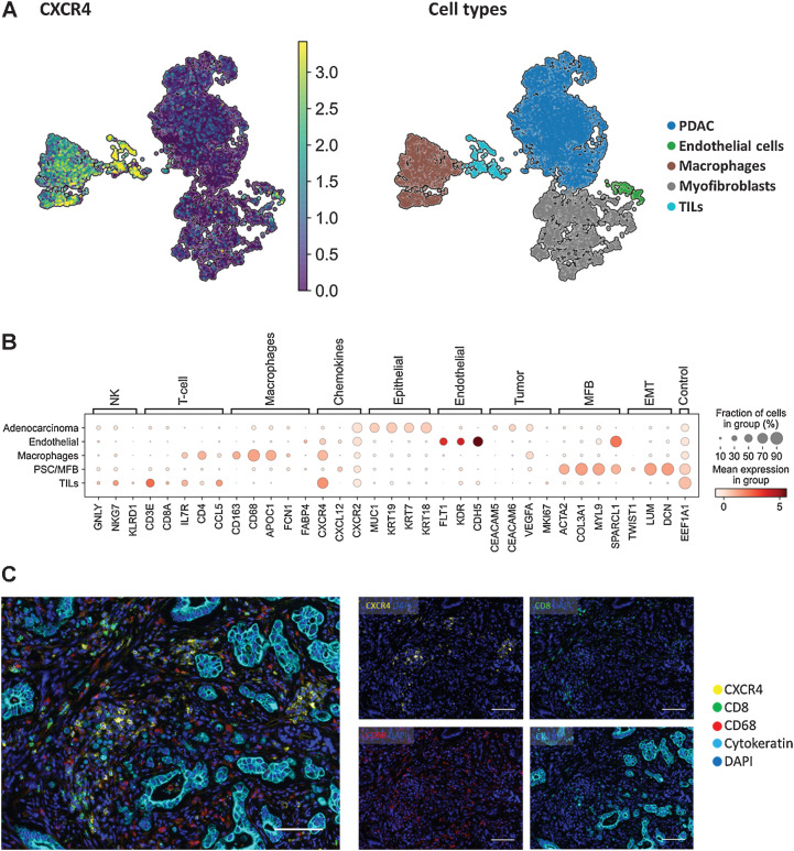 Figure 6. Single-cell analysis reveals CXCR4 mRNA expression on macrophages and tumor-infiltrating lymphocytes in a publicly available PDAC dataset. A, Integrated UMAP for CXCR4, CD3E, CD68 and the respective annotated cell types from dissociated primary tumors obtained from patients with PDAC (n = 10). Strong CXCR4 gene expression was found in the macrophages and tumor-infiltrating lymphocytes cell clusters. B, Dotblot expression analysis of annotated cell types in the dataset with cell type–specific markers and targets CXCR4, CXCL12. C, Representative immunofluorescence images of a PDAC sample with CXCR4 expression on macrophages and CD8+ T-cells. mIF staining of CXCR4 (yellow), CD8 (green), CD68 (red), Cytokeratin (cyan), and DAPI (blue) in PDAC. Scale bar 100 μmol/L.