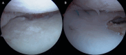 Fig. 11