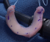 Fig. 10