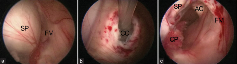 Figure 4: