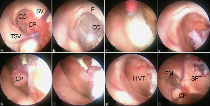 Figure 3: