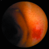 Fig 2