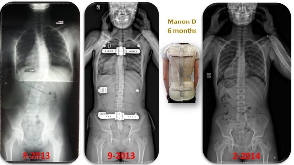 Figure 25