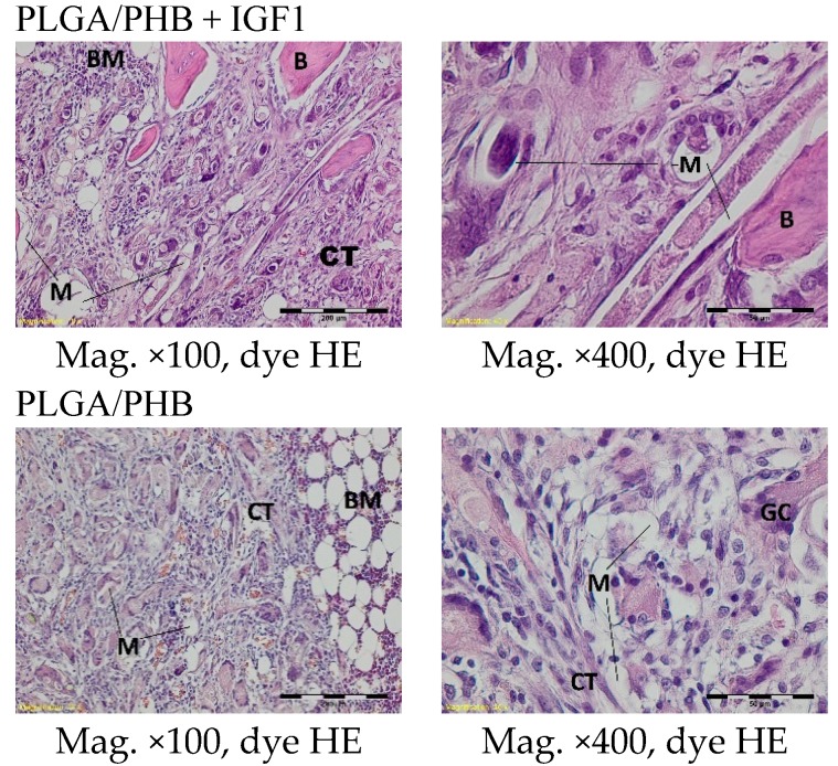 Figure 14