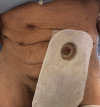 FIG. 3.