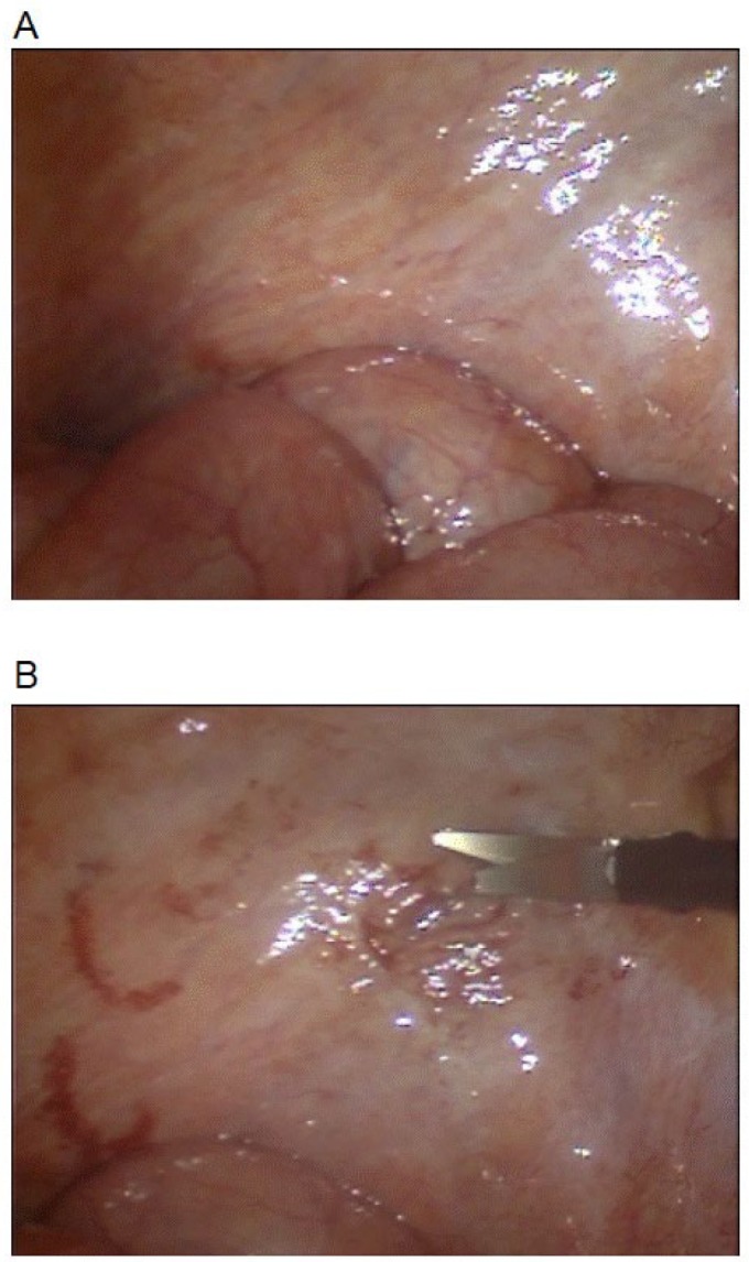 Figure 1 —