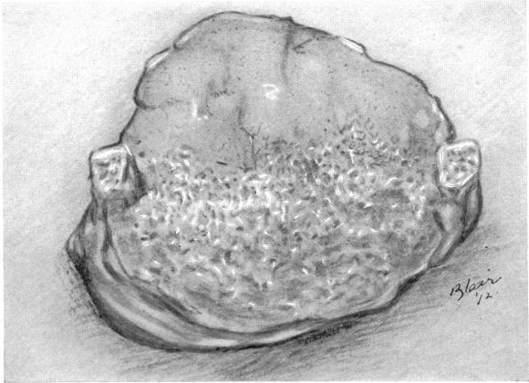 FIG. 5.