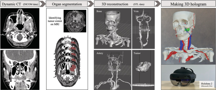 FIGURE 1