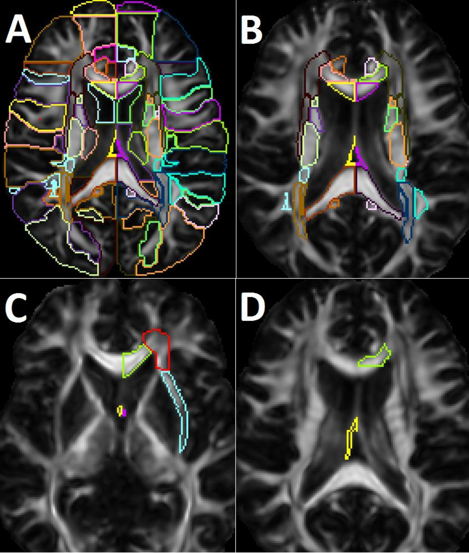 Figure 1A