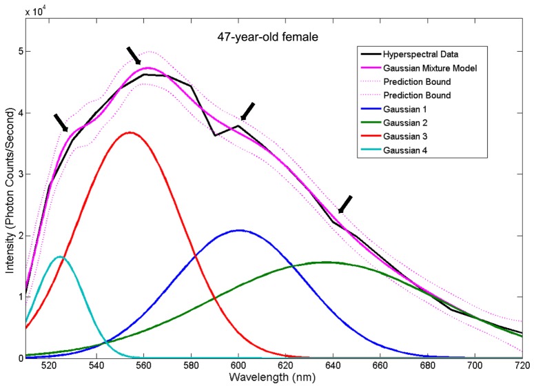 Fig. 3