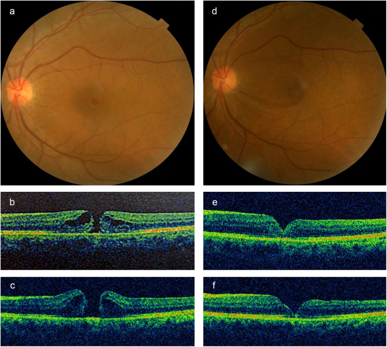 Fig. 3